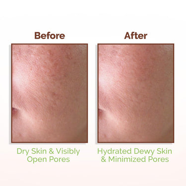 Mamaearth Rice Water Dewy Face Toner with Rice Water & 4% Niacinamide for Glass Skin 150ml |Intensely Hydrates |Minimizes Pores |Even Skin Tone |Korean Rice Toner | Alcohol-Free| Suits All Skin Types